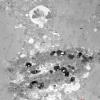 2B1 Hydroxychloroquine, muscle (Case 2) EM 036 copy - Copy