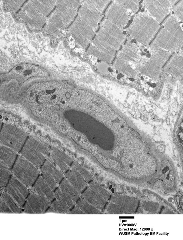 5A1 (Case 5) Muscle_007 - Copy