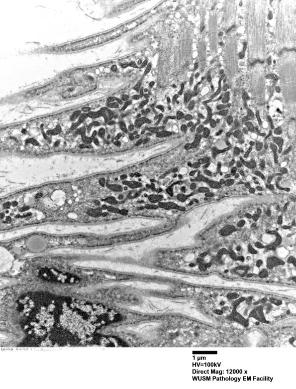 5B0 (Case 5) Muscle_048 - Copy