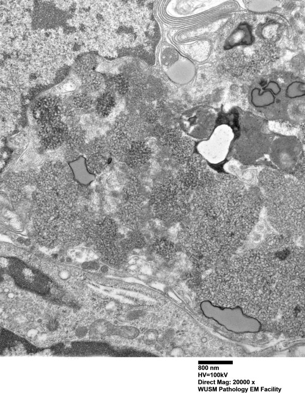 5B1C (Case 5) Muscle_052 - Copy