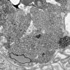5B1D (Case 5) Muscle_051 - Copy