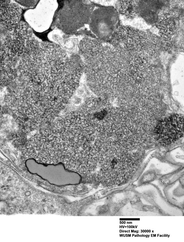 5B1D (Case 5) Muscle_051 - Copy