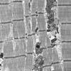 5B2A (Case 5) Muscle_056 - Copy