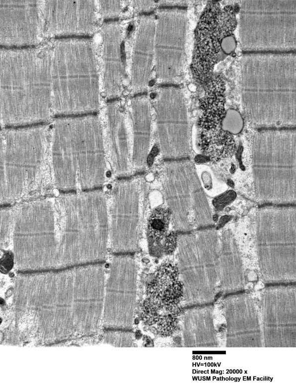 5B2A (Case 5) Muscle_056 - Copy