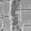 5B2B (Case 5) Muscle_057 - Copy