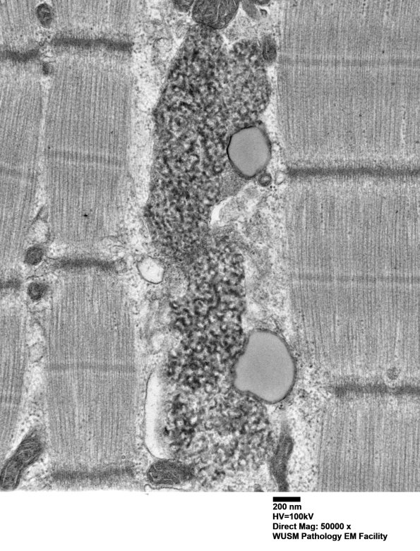 5B2B (Case 5) Muscle_057 - Copy