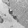 5B3A (Case 5) Muscle_035 - Copy