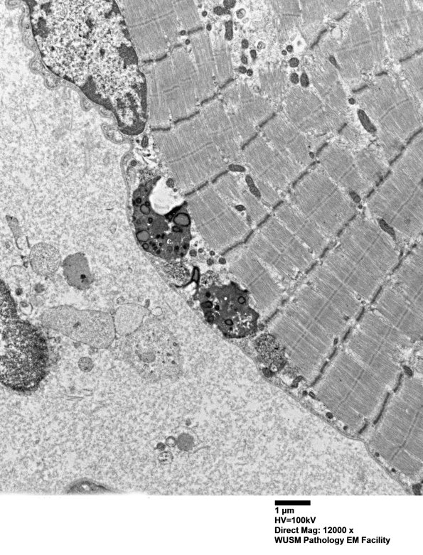 5B3A (Case 5) Muscle_035 - Copy