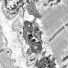 5B3B (Case 5) Muscle_036 - Copy