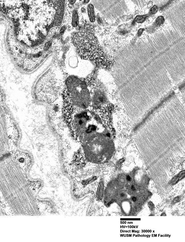 5B3B (Case 5) Muscle_036 - Copy