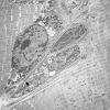 5B4A (Case 5) Muscle_025 - Copy