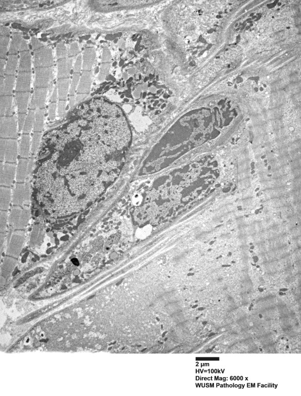 5B4A (Case 5) Muscle_025 - Copy