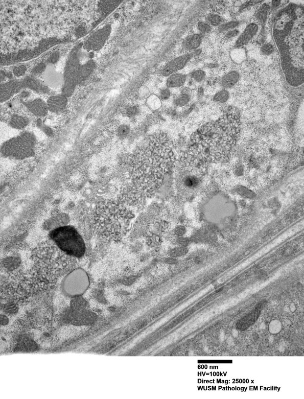 5B4B (Case 5) Muscle_023 - Copy