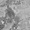 5B5A (Case 5) Muscle_063 - Copy