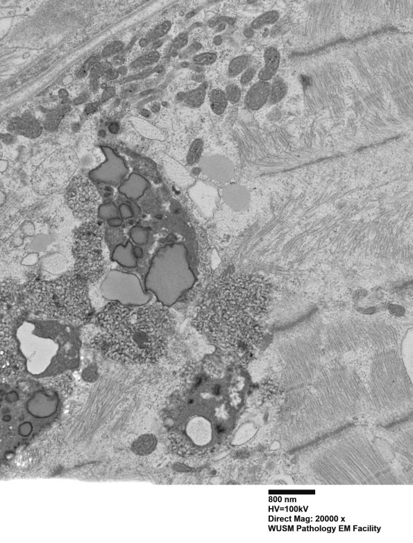 5B5A (Case 5) Muscle_063 - Copy