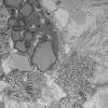 5B5B (Case 5) Muscle_065 - Copy