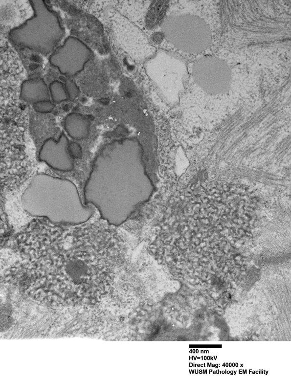 5B5B (Case 5) Muscle_065 - Copy