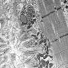 5B6A (Case 5) Muscle_043 - Copy