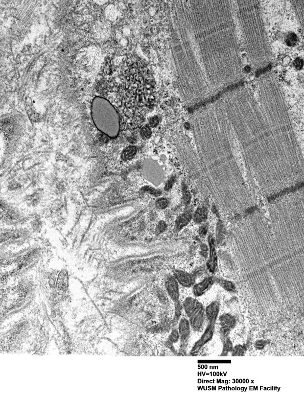 5B6A (Case 5) Muscle_043 - Copy
