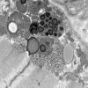5B6B (Case 5) Muscle_040 - Copy