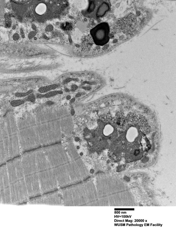 5B6C (Case 5) Muscle_046 - Copy