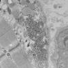 5B6D (Case 5) Muscle_042 - Copy
