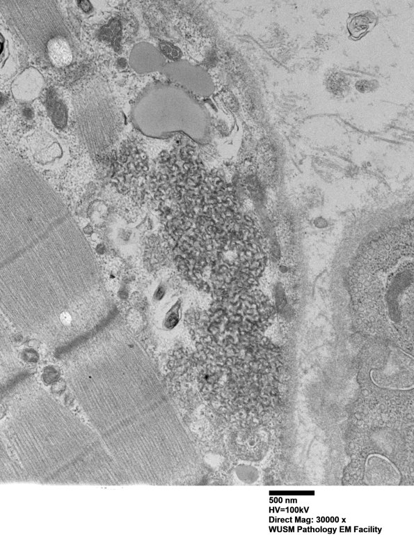 5B6D (Case 5) Muscle_042 - Copy