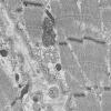 5B6E (Case 5) Muscle_037 - Copy