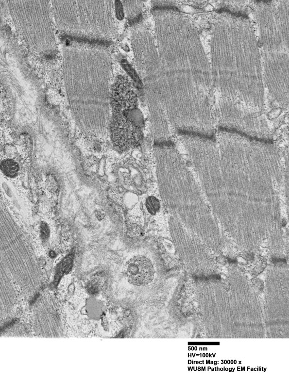 5B6E (Case 5) Muscle_037 - Copy
