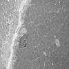6C3A HCG (Case 6) EM 018 - Copy