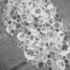 6C3C HCG (Case 6) EM 021 - Copy