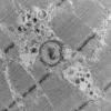 6C4 HCG (Case 6) EM 036 - Copy