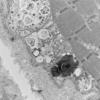 6C5 HCG (Case 6) EM 024 - Copy