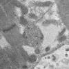 6D1B HCG (Case 6) EM 031 - Copy