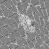 6D4A HCG (Case 6) EM 003 - Copy