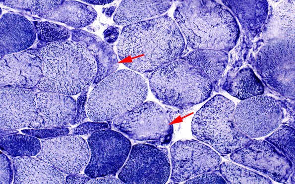 1C1 (Case 1) muscle NADH 40X copy