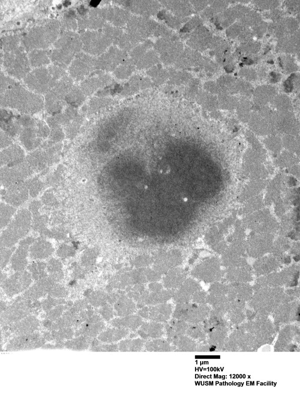 3B2A (Case 3) muscle_021 - Copy