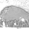 2A1 (Case 2) EM032 - Copy
