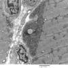 1A1A-Case-1-EM006-Copy.jpg