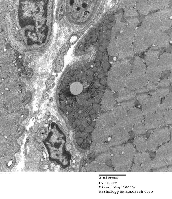 1A1A-Case-1-EM006-Copy.jpg