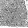 Inclusions - Membranous, multilamellar