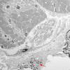 2A1A-Case-2-EM007-copy-Copy.jpg