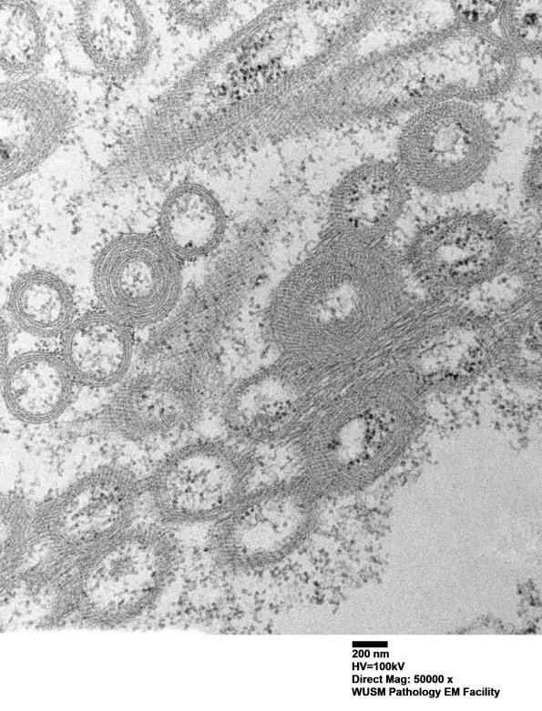 2A1C (Case 2) EM009 - Copy