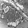 1H6A (Case 1) EM Image7, 11Kx - Copy