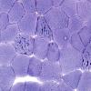 Inclusions - Tubular