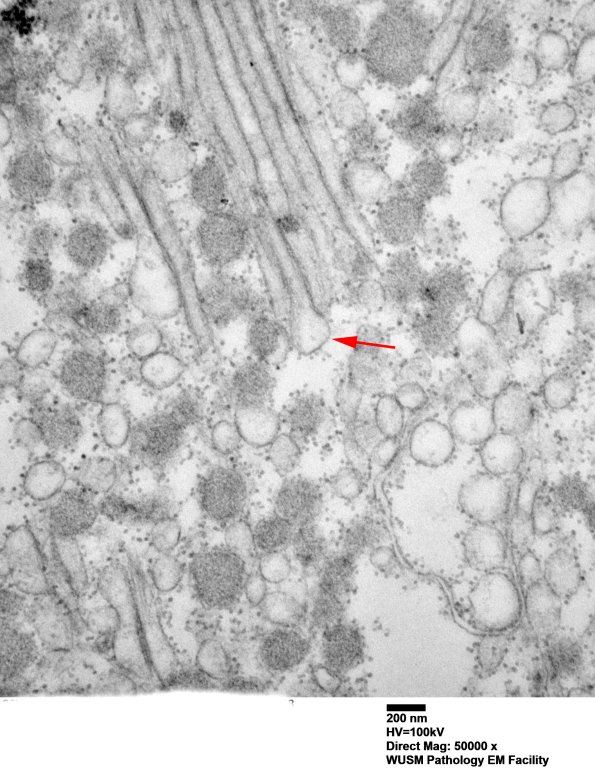 2F1C  (Case 2) EM 008 copy - Copy