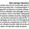 0A Macrophagic Myofasciitis - Text