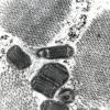 12A2 Mitochondrial Myopathy (Case 12) EM 1 - Copy
