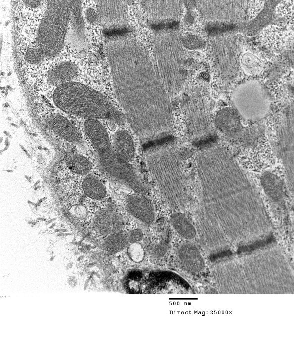 13A1D (Case 13) Muscle_041 - Copy