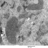 14A7B Case 14 025 - Copy